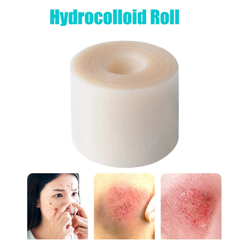 Hydrocolloid Roll