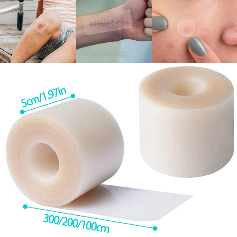 Hydrocolloid Roll