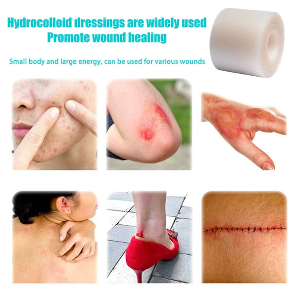 Hydrocolloid Roll