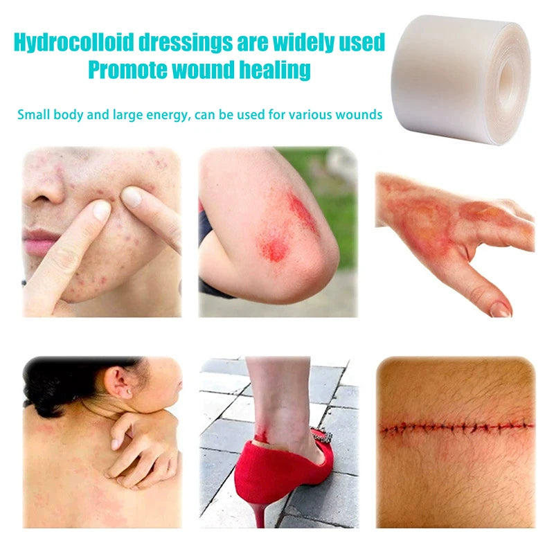 Hydrocolloid Roll