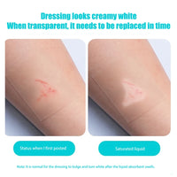 Hydrocolloid Roll