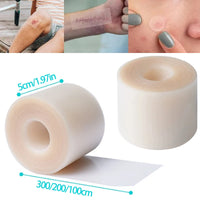 Hydrocolloid Roll